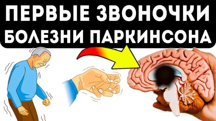 Популярная еда теперь связана с болезнью Паркинсона, и врачи предупреждают об этом
