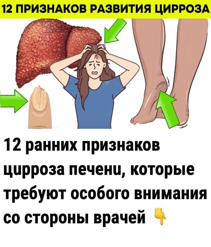 «Печень не болит — она просто умирает. Признаки, которые невозможно игнорировать»