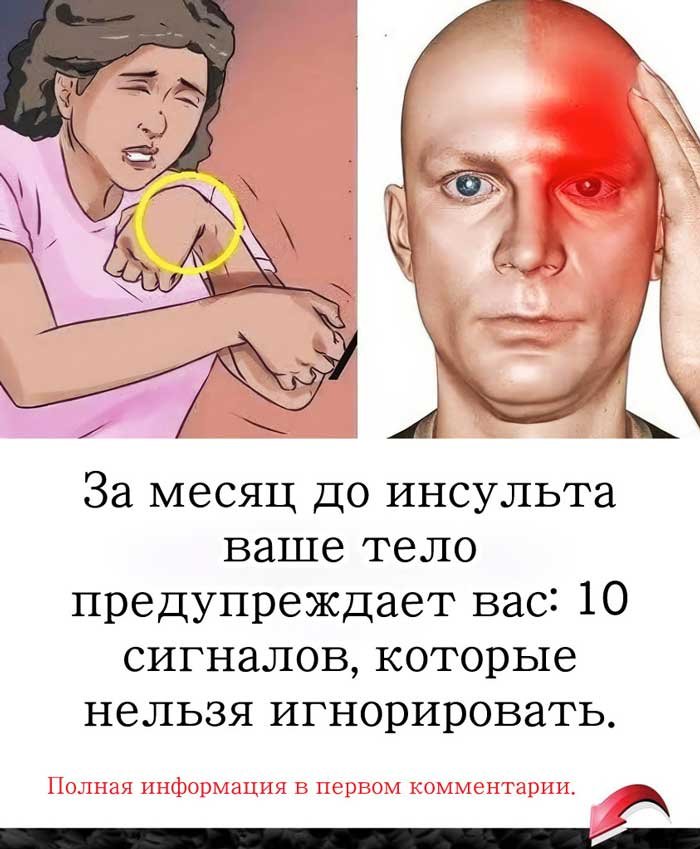 «Врачи предупреждают: инсульт начинается за 30 дней, но мало кто это понимает»